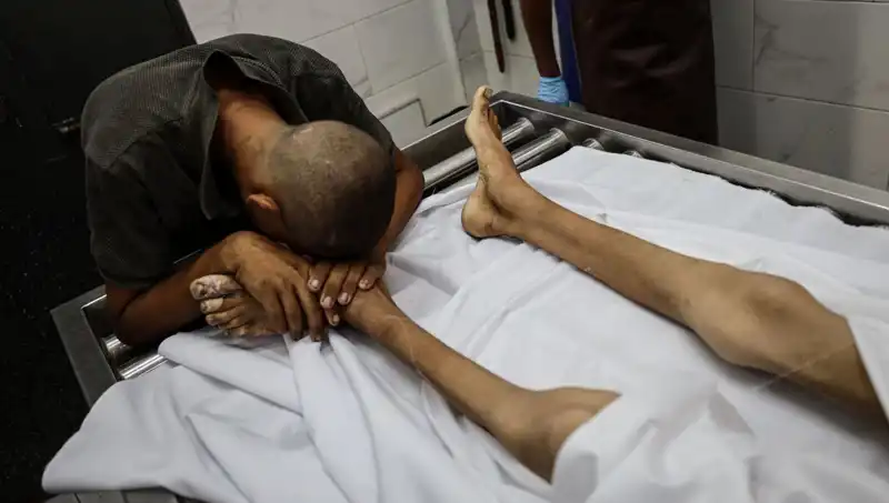 Gazze'de Her Geçen Gün Çocuk Ölümleri Artıyor: Açlık Korkunç Bir Gerçek