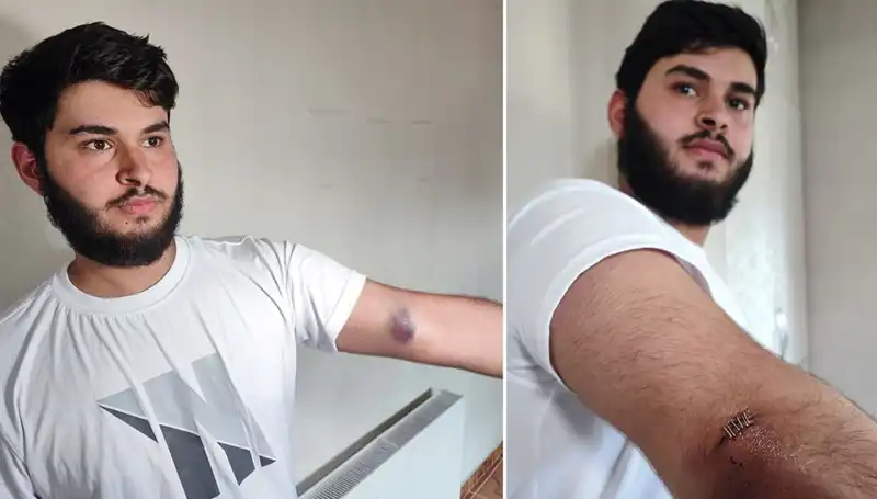 Bahçeye Kaçan Top, Mahallede Büyük Bir Kaosa Neden Oldu